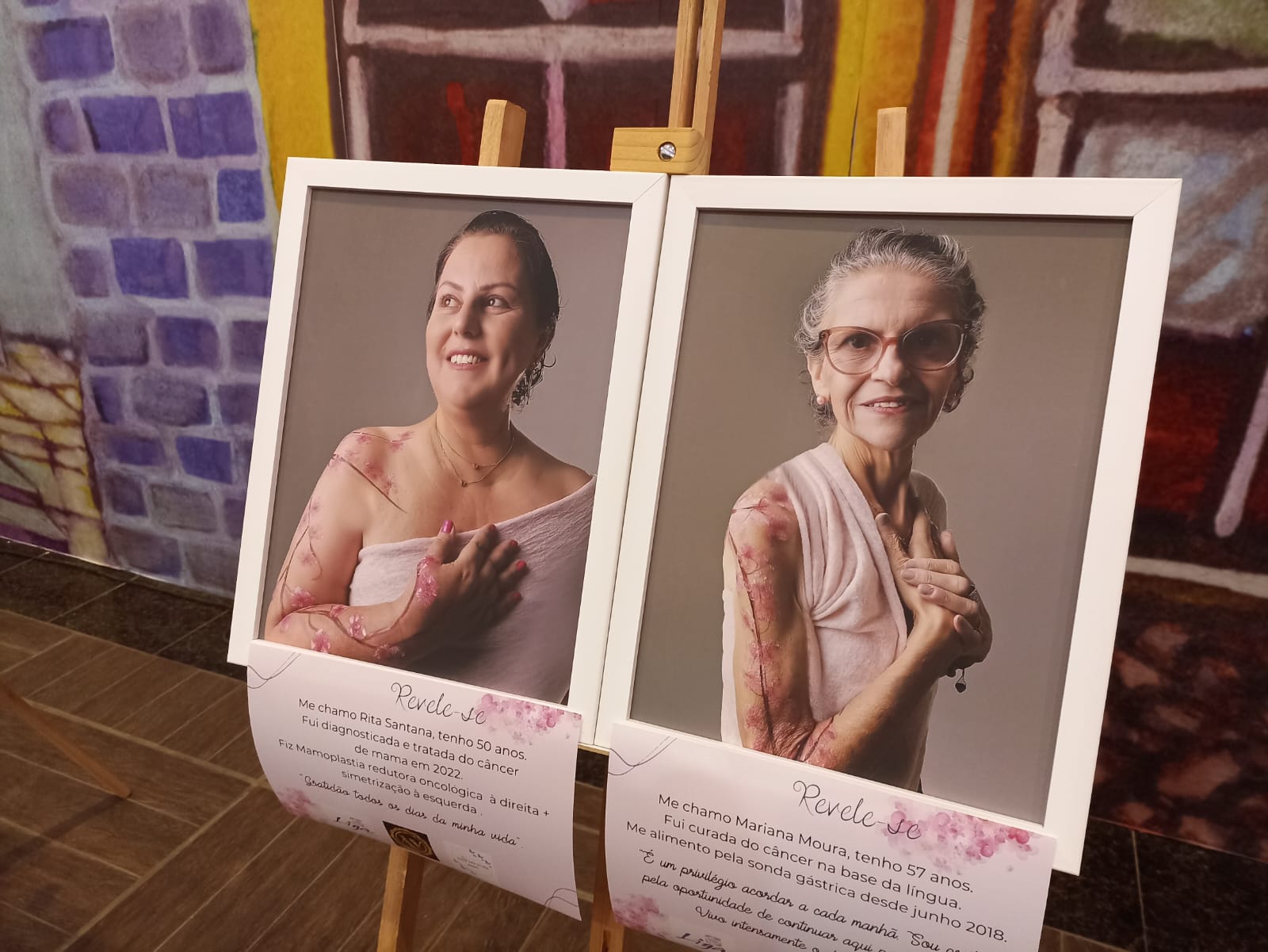 Beleza e resiliência de mulheres em tratamento contra o câncer inspira exposição em Gravataí